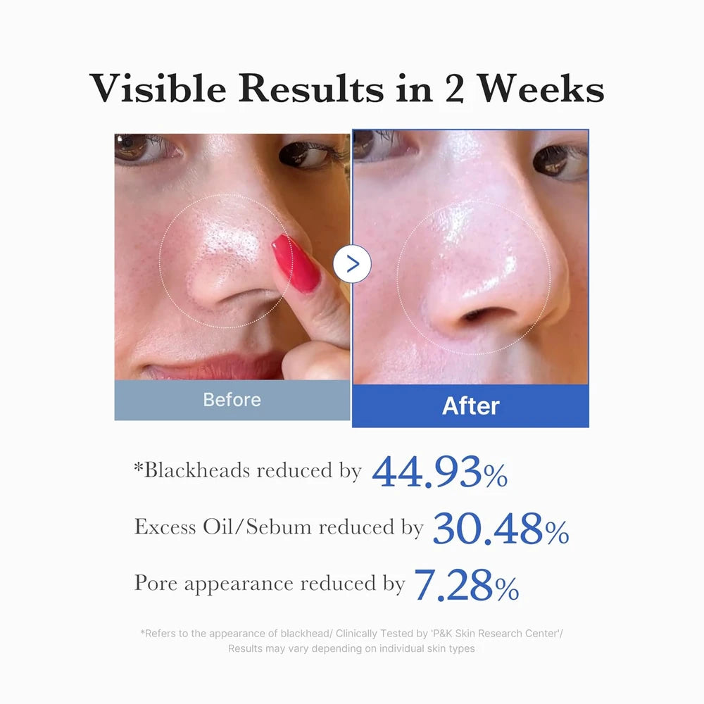 Medicube Zero Pore Pad