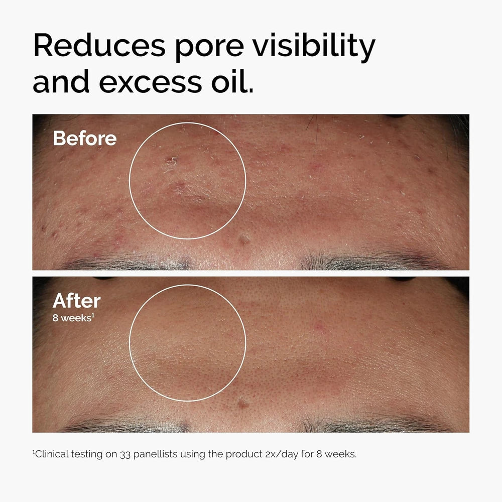 Niacinamide 10% Zinc 1% Smoothing Serum