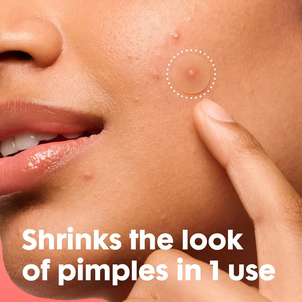 Mighty Patch Overnight Pimple Patches